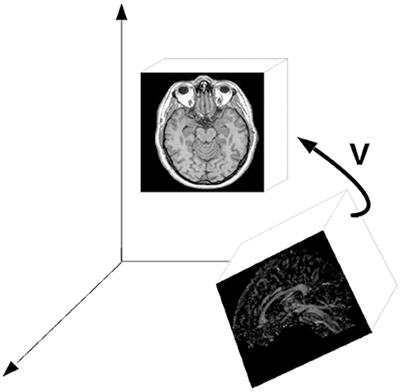 Multi-Modality Imaging: A Software Fusion and Image-Guided Therapy Perspective